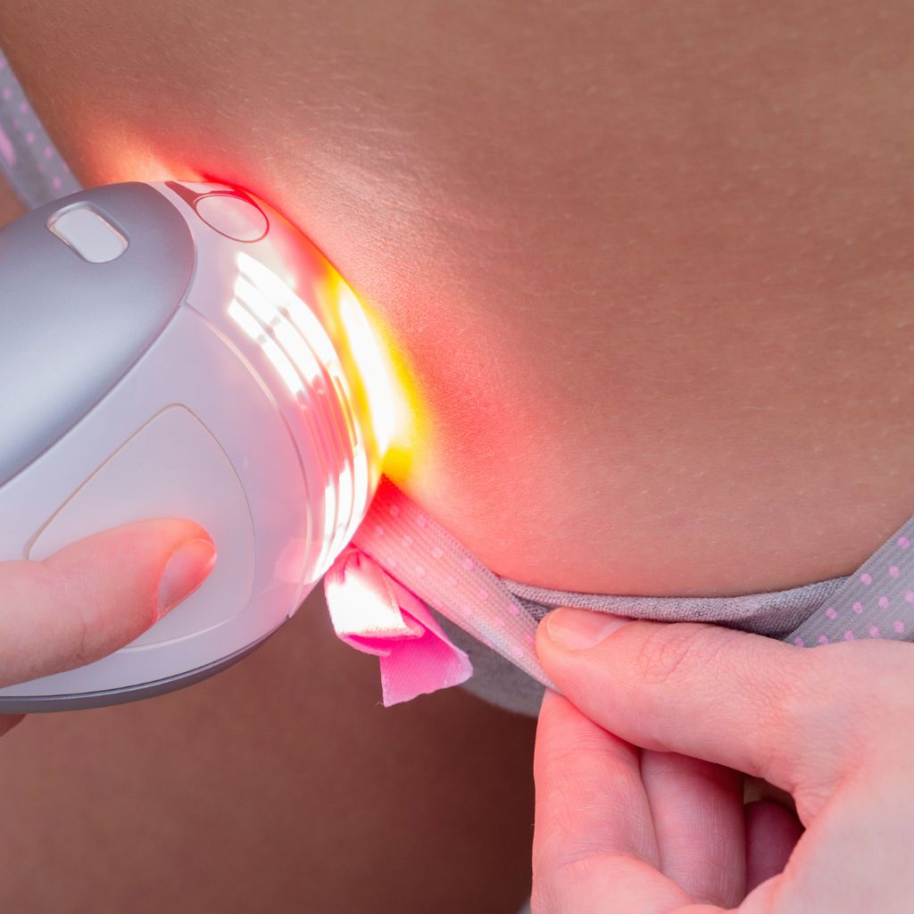 Epilation définitive maillot : le guide ultime pour s’y mettre
