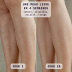 Avant / après épilation des jambes à la lumière pulsée Bodysiam, jour 1 et jour 28