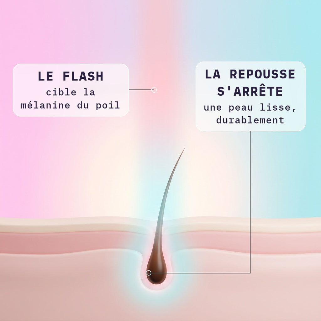 Comment fonctionne l'épilation à la lumière pulsée : le flash cible la mélanine du poil et la repousse s'arrête