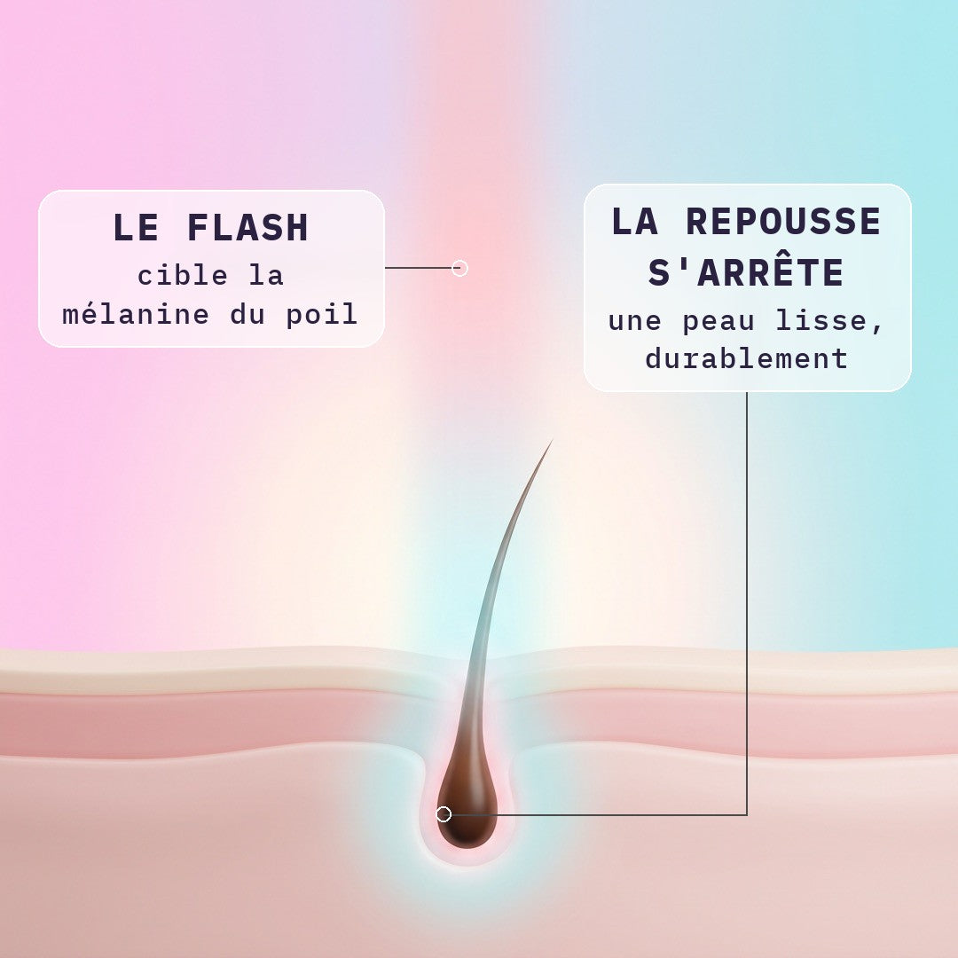 Comment fonctionne l'épilation à la lumière pulsée : le flash cible la mélanine du poil et la repousse s'arrête