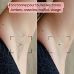 Epilateur Lumiere Pulsée - Bodysiam Skin Expert Lite