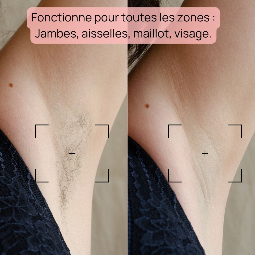 Epilateur Lumiere Pulsée - Bodysiam Skin Expert Lite