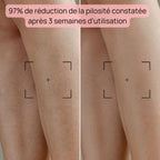 Epilateur Lumiere Pulsée - Bodysiam Skin Expert Lite