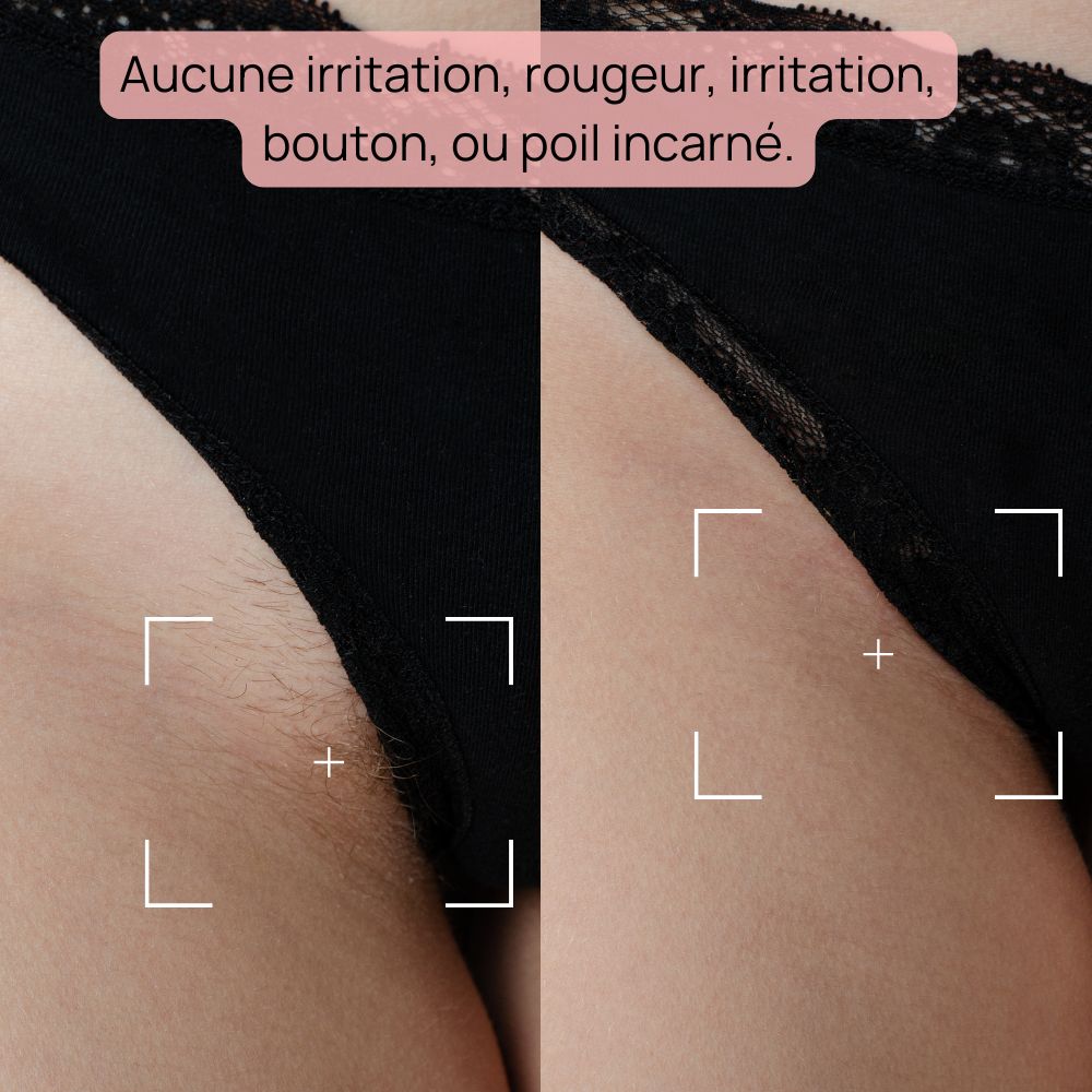 Epilateur Lumiere Pulsée - Bodysiam Skin Expert Lite