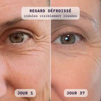 Avant / après masque LED visage Bodysiam sur le contour des yeux, jour 1 et jour 37