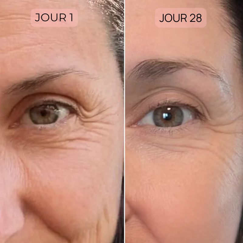 Masque Led Visage