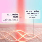 Comment fonctionne le masque LED : la lumière rouge pénètre jusqu'au derme et relance le collagène